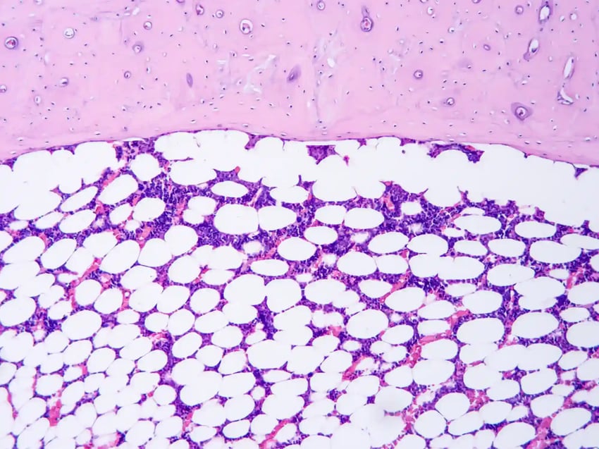 microréseaux de tissus